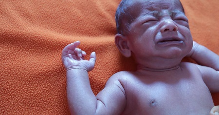 انواع سیانوز در نوزادان, درمان سیانوز در نوزادان, علایم سیانوز در نوزادان