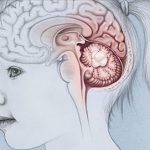 علائم، دلایل، تشخیص و روش درمانی تومور مغزی در کودکان