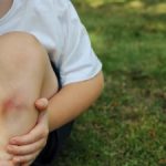 کبود شدن بدن کودکان: چه چیزی طبیعی است و چه زمانی باید نگران بود